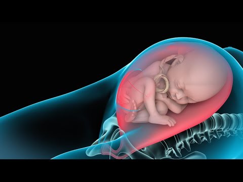 Cesarean Birth (C-section) Delivery & Birth