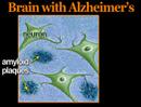 Understanding Alzheimer’s Disease (Alzheimers #1)